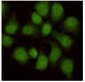 Anti-WDR77 Antibody (8A10-C10-E8)
